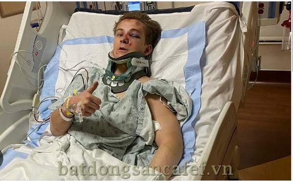 Bareback Rider Austin Broderson hospitalized after dismount accident